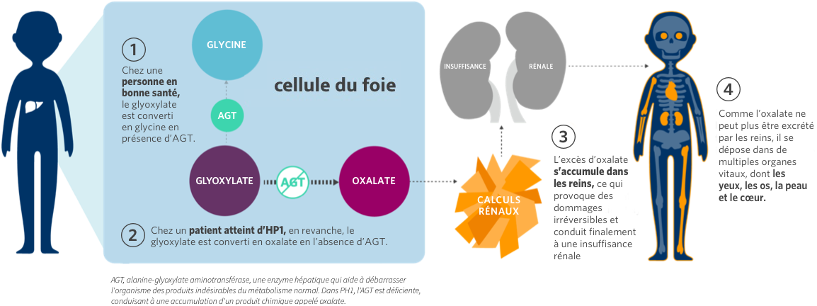 L’hyperoxalurie primitive de type 1 (HP1) dans l'organisme 