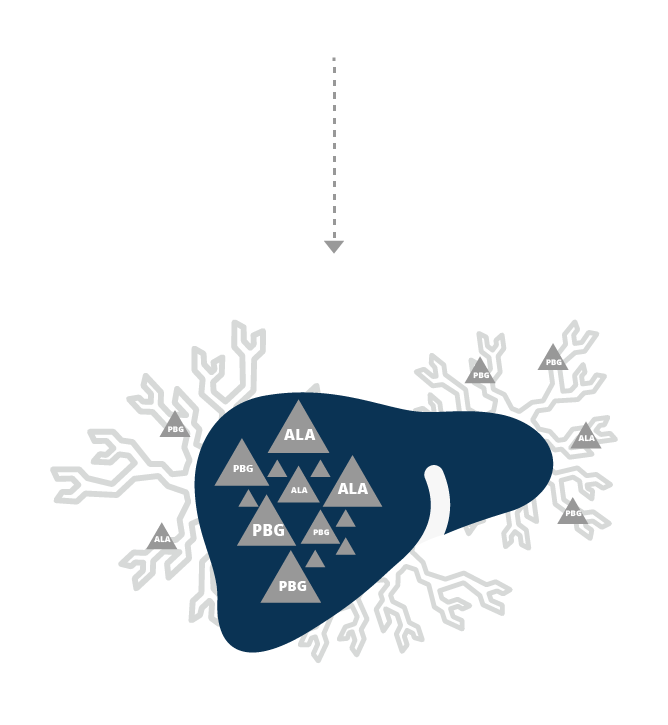 PHA - accumulation d’intermédiaires neurotoxiques - l’acide aminolévulinique (ALA) et le porphobilinogène (PBG) 